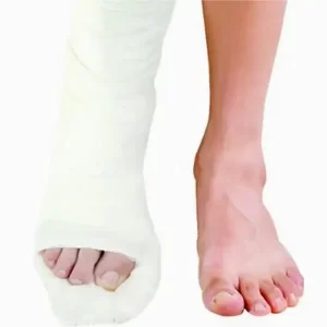 Plaster of Paris